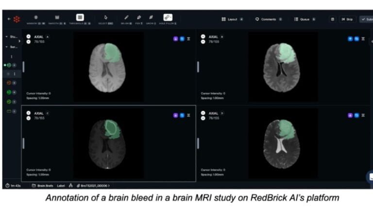 RedBrick AI gets $4.6M to expand the market for its healthcare solution