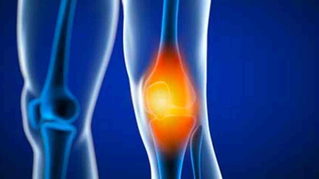 the-truth-behind-knee-replacement-surgery-myths-what-you