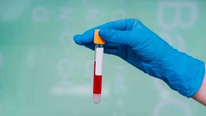 preeclampsia blood test