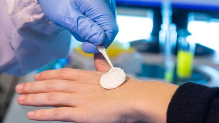 Heal Burns Fast! New Vitamin C-rich Bandage to Boost Burn Healing