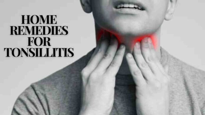 Home Remedies for Tonsillitis