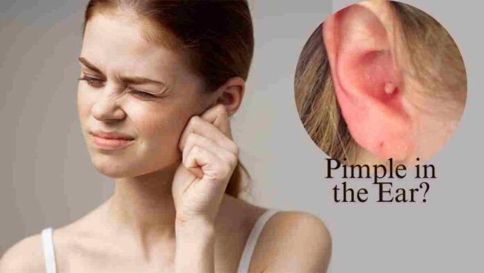 Ear pimples treatment
