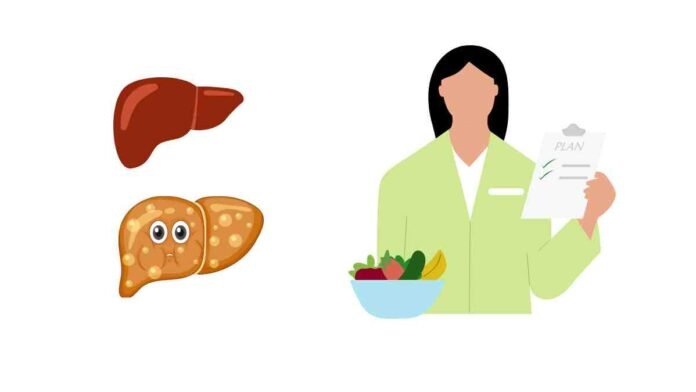Fatty Liver Diet