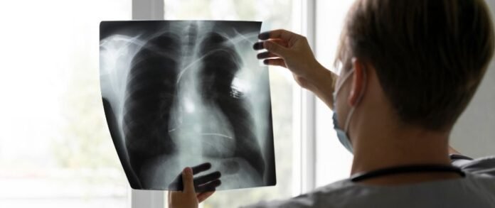 Doctors Urge Caution As Pollution Increases Threat Of Pneumonia Doctors Urge Caution As Pollution Increases Threat Of Pneumonia