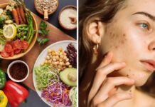 Acne Not Going Away? These Foods Could Be Why Foods that cause acne and foods for clear skin