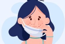 Acne Scar Gel Explained: How it Works, When to Use it, and Best Practices